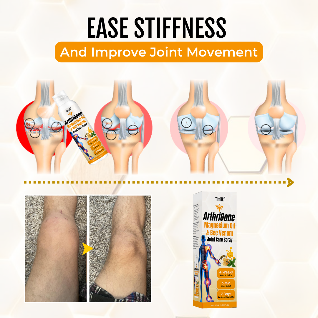 ArthriGone Magnesium Oil & Bee Venom Joint Care Spray