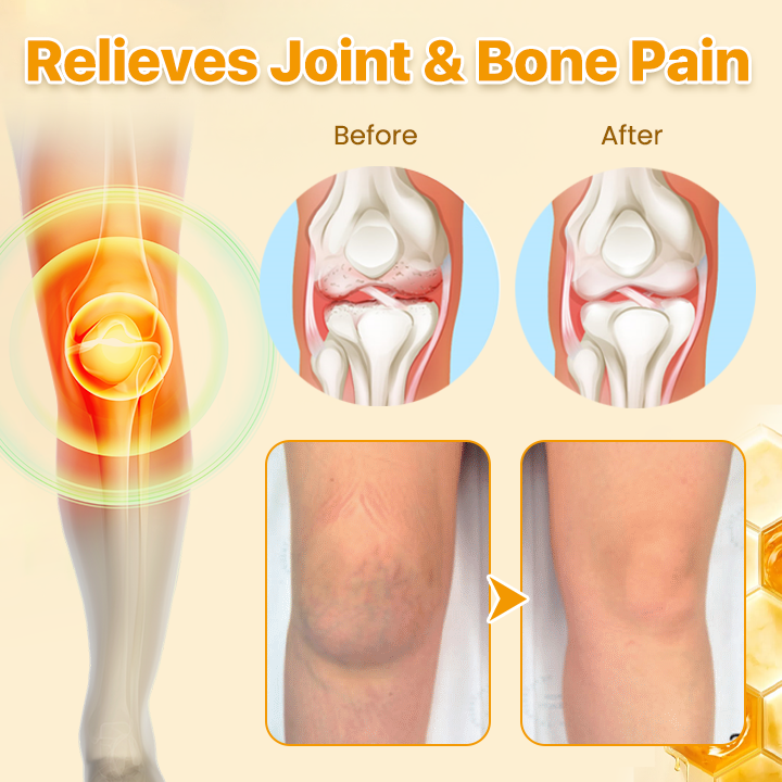 Biancat® Bee Venom Joint Pain Relief & Healing Cream
