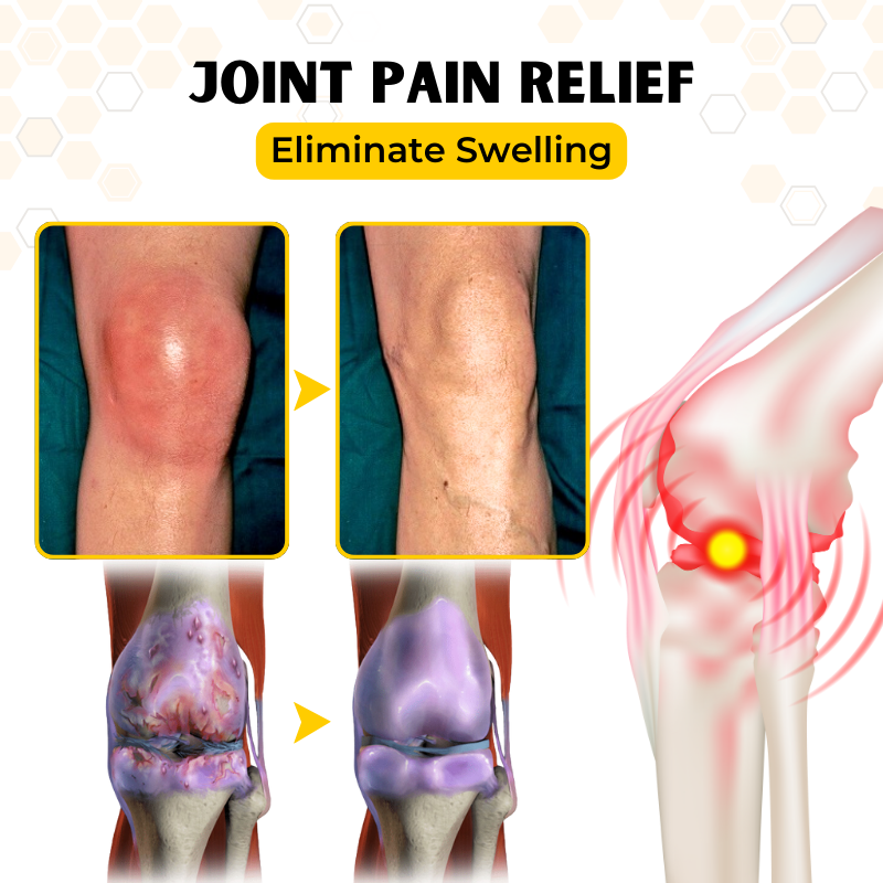 Biancat® OrthoRestore Bee Venom Joint Relief Cream (New Formula)