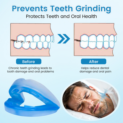 Last Day Promotion ⏰ PerfectSleep Solution- Anti-Snoring & Anti-Grinding Teeth Protector